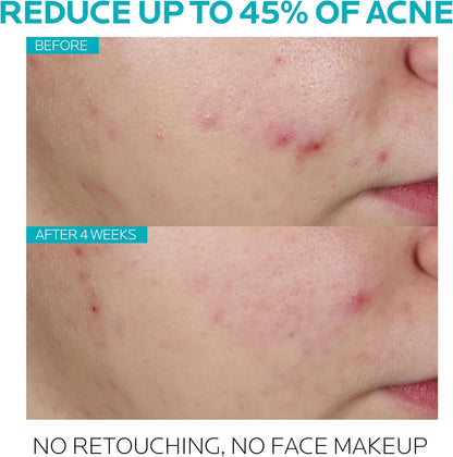 La Roche Posay Effaclar Serum